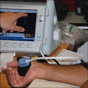 Inspectra Tissue Oxygenation monitor