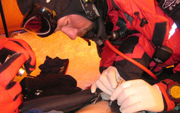Mike Grocott at work on the summit