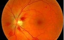 A retinal scan image