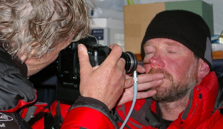 Photographing the nasal mucosa at EBC