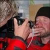 Photographing the nasal mucosa at EBC
