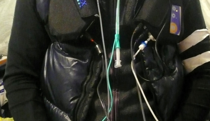 Comprehensively measuring oxygen delivery at EBC